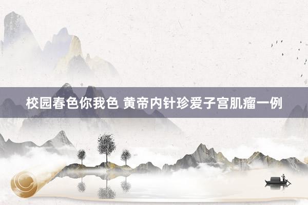 校园春色你我色 黄帝内针珍爱子宫肌瘤一例
